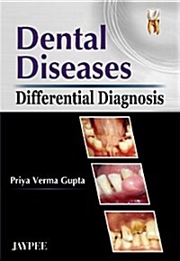 Dental Diseases (Differential Diagnosis) (Paperback)