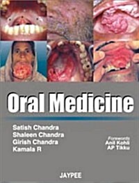 Oral Medicine (Paperback, 1st)