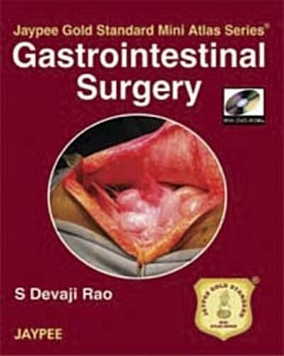 Jaypee Gold Standard Mini Atlas Series: Gastrointestinal Surgery (Hardcover)