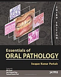 Essentials of Oral Pathology (Paperback, 3)