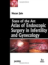 State-Of-The-Art Atlas of Endoscopic Surgery in Infertility and Gynecology (Hardcover, 2)