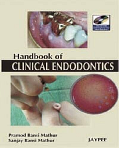 A Hand Book of Clinical Endodontics (Paperback)