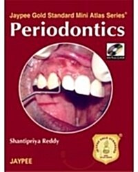 Periodontics (Paperback, DVD, 1st)