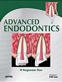 Advanced Endodontics (Hardcover, 1st)