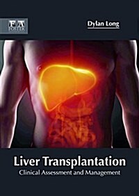 Liver Transplantation: Clinical Assessment and Management (Hardcover)