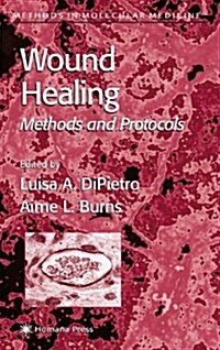 Wound Healing: Methods and Protocols (Hardcover)