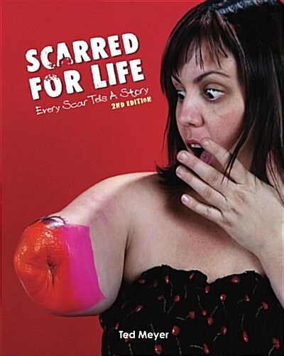 Scarred for Life. 2nd Edition: Every Scar Tells a Story (Paperback)