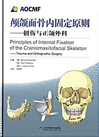 颅颌面骨內固定原则:创傷與正颌外科 (精裝, 第1版)