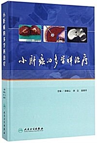 小肝癌的多學科治療 (精裝, 第1版)