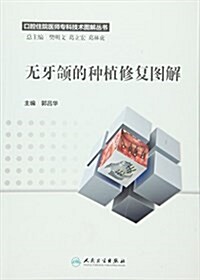 口腔住院醫師专科技術圖解叢书:無牙颌的种植修复圖解 (平裝, 第1版)