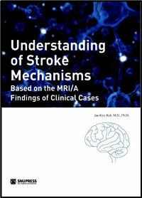 Understanding of stroke mechanisms : based on the MRI/A findings of clinical cases
