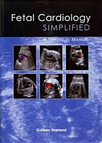 Fetal Cardiology Simplified : A Practical Manual (Paperback)