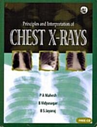 Principles and Interpretation of Chest X-Rays [With CDROM] (Paperback)