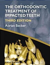 Orthodontic Treatment of Impacted Teeth (Hardcover, 3rd Edition)