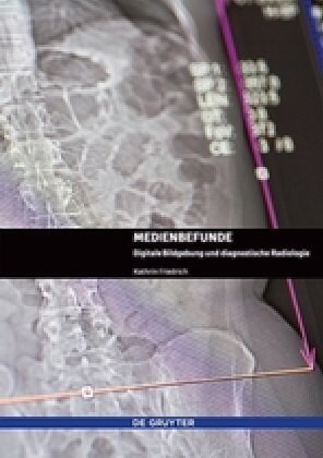 Medienbefunde: Digitale Bildgebung Und Diagnostische Radiologie (Paperback)