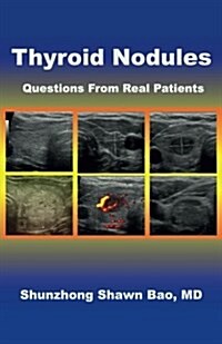 Thyroid Nodules: Questions from Real Patients (Paperback)