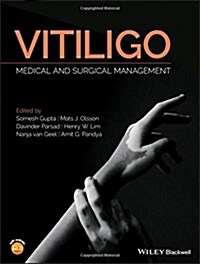 Vitiligo: Medical and Surgical Management (Hardcover)
