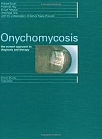 Onychomycosis (Hardcover, 1)