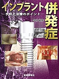 インプラント倂發症―予防と治療のポイント (大型本)