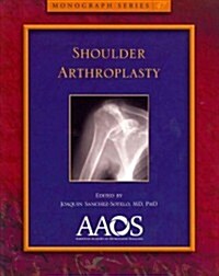 Shoulder Arthroplasty (Paperback, 1st)