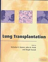 Lung Transplantation (Hardcover, New)