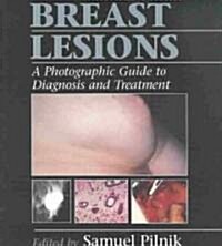 Common Breast Lesions : A Photographic Guide to Diagnosis and Treatment (Hardcover)