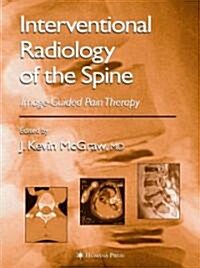 Interventional Radiology of the Spine: Image-Guided Pain Therapy (Hardcover, 2004)