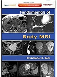 Fundamentals of Body MRI: Expert Consult- Online and Print (Paperback)