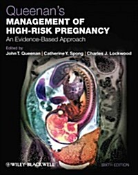 Queenans Management of High-Risk Pregnancy: An Evidence-Based Approach (Hardcover, 6)