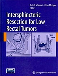 Intersphincteric Resection for Low Rectal Tumors (Hardcover, 2012)