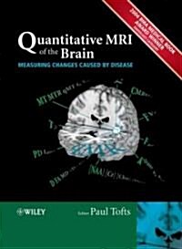 Quantitative Mri of the Brain (Hardcover)