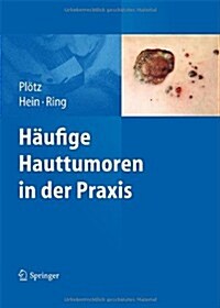 Haufige Hauttumoren in Der Praxis (Hardcover)