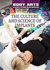 The Culture and Science of Implants (Library Binding)