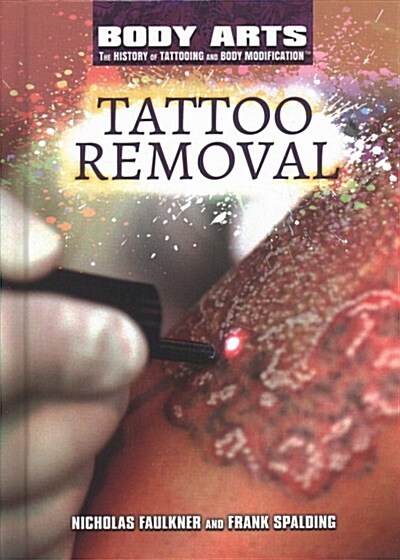 Tattoo Removal (Library Binding)