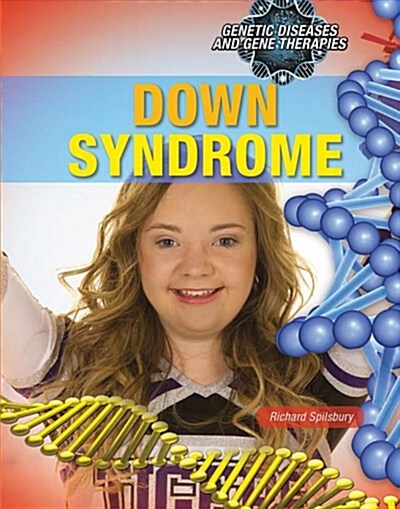 Down Syndrome (Library Binding)