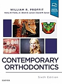 Contemporary Orthodontics (Hardcover, 6)