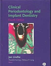 [중고] Clinical Periodontology and Implant Dentistry (Hardcover, 4th, Illustrated)