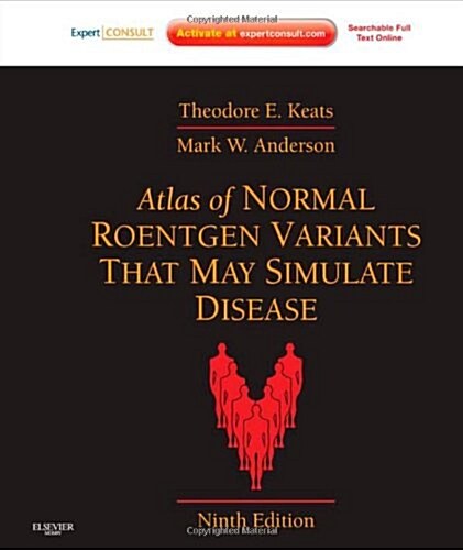 Atlas of Normal Roentgen Variants That May Simulate Disease: Expert Consult - Enhanced Online Features and Print (Hardcover, 9, Revised)