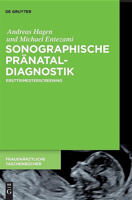 Sonographische Pr?ataldiagnostik (Hardcover)