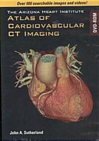 Arizona Heart Institute Atlas of Cardiovascular CT Imaging DVD-ROM (Hardcover)