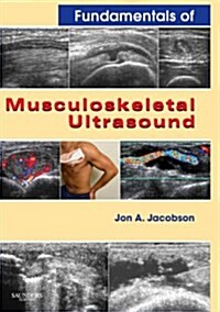 Fundamentals of Musculoskeletal Ultrasound (Paperback, 1st)