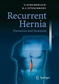 Recurrent Hernia (Hardcover, 1st)