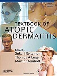 Textbook of Atopic Dermatitis (Hardcover)