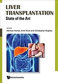 Liver Transplantation: State of the Art (Hardcover)