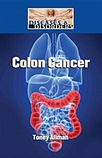 Colon Cancer (Library Binding)