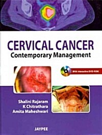 Cervical Cancer (Paperback, DVD, 1st)