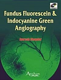 Fundus Fluorescein and Indocyanine Green Angiography (Hardcover)