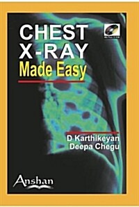 Chest X-Ray [With CDROM] (Paperback)