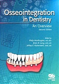 Osseointegration in Dentistry (Paperback, 2nd)