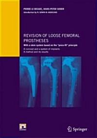 Revision of Loose Femoral Prostheses with a Stem System Based on the Press-Fit Principle: A Concept and Its System of Implants, a Method and Its Res (Paperback, 2007)